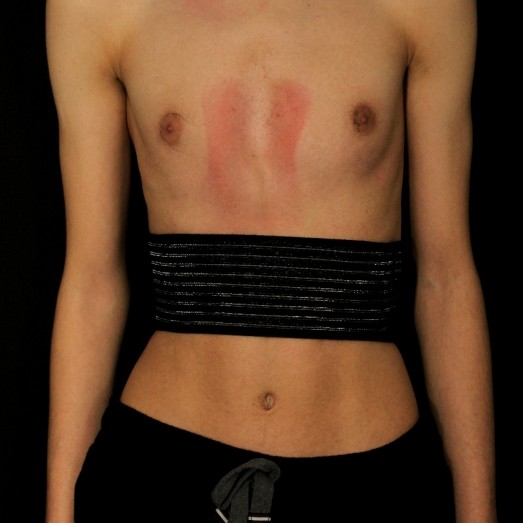 Gpad Rib Flare uso