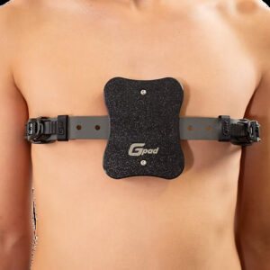 Campana de Vacío Gvacuum Vacuum Bell — Pectus Excavatum